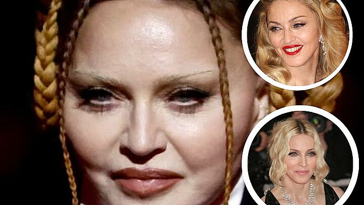 Madonna estalla contra quienes la criticaron por su físico: “Estoy atrapada en la discriminación por edad y misoginia”