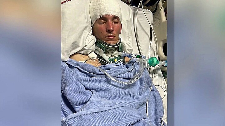 Cubano hospitalizado tras accidente