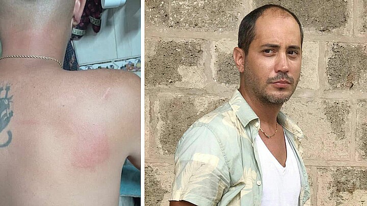 Violento asalto con palo de golf a actor Frank Mora en La Habana