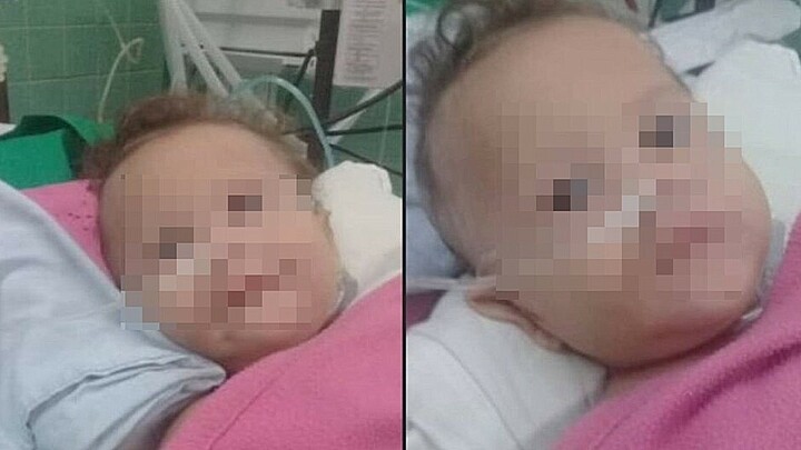  Bebé comienza a respirar sola tras graves heridas en accidente en Guantánamo, Cuba