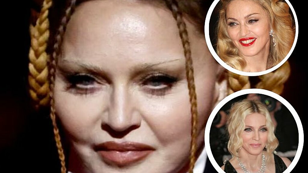 Madonna estalla contra quienes la criticaron por su físico: “Estoy atrapada en la discriminación por edad y misoginia”