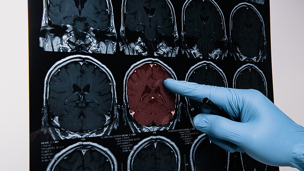 Médicos revisando radiografías del cerebro