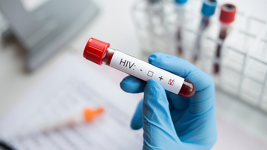 Nuevos avances para una vacuna contra el VIH están publicados 