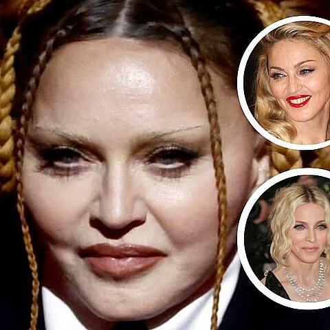 Madonna estalla contra quienes la criticaron por su físico: “Estoy atrapada en la discriminación por edad y misoginia”