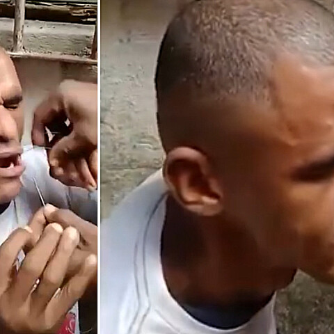 Un cubano opositor identificado como Josiel Guía Piloto cosió su boca en el barrio San Isidro