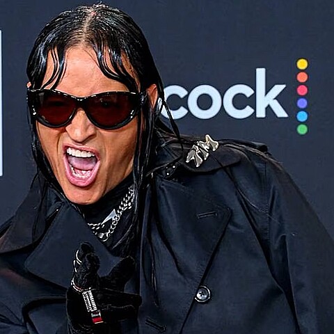 Elvis crespo cambió totalmente su look para el partido de béisbol 