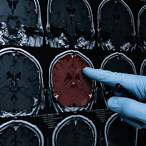 Médicos revisando radiografías del cerebro