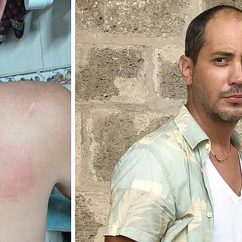Violento asalto con palo de golf a actor Frank Mora en La Habana