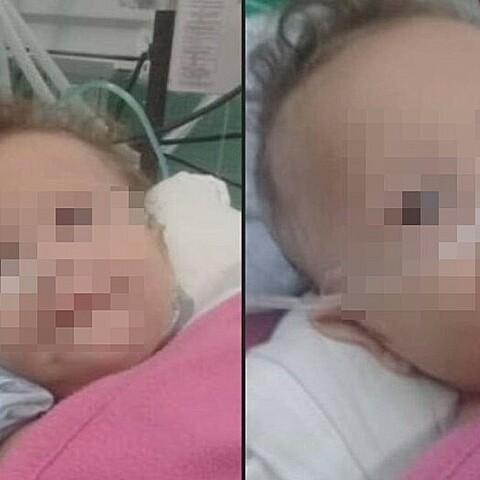  Bebé comienza a respirar sola tras graves heridas en accidente en Guantánamo, Cuba