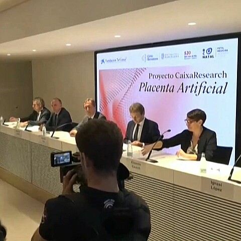 Pplacventa artificial