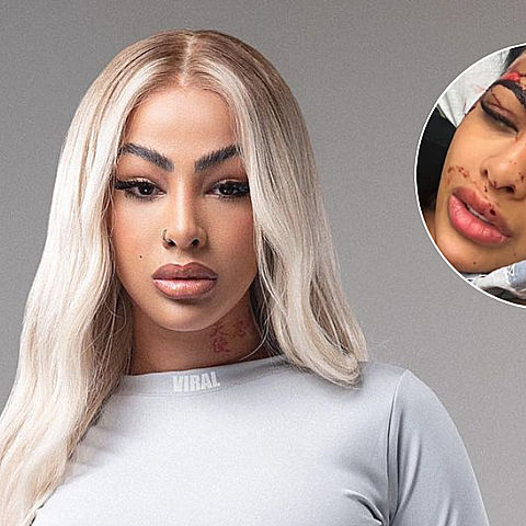 La rapera dominicana apareció golpeada en sus redes sociales, y explicó todo 