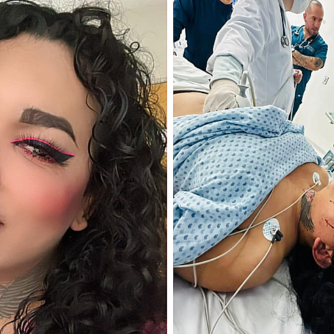 La creadora de contenido podría perder un ojo tras presunta golpiza