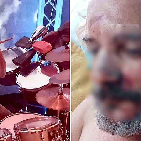 Violento asalto contra músico cubano en La Habana