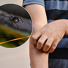 Un niño de 8 años se dejó picar por una araña venenosa en Bolivia