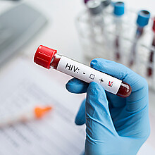 Nuevos avances para una vacuna contra el VIH están publicados 
